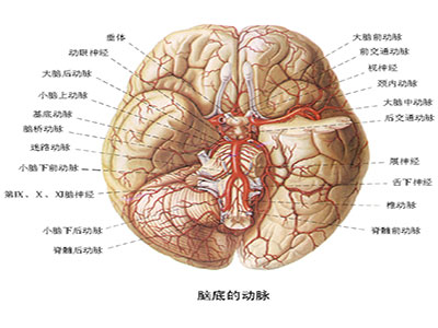 腦出血疾病介紹