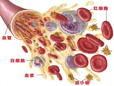 患者警惕這些疾病容易引發腦出血