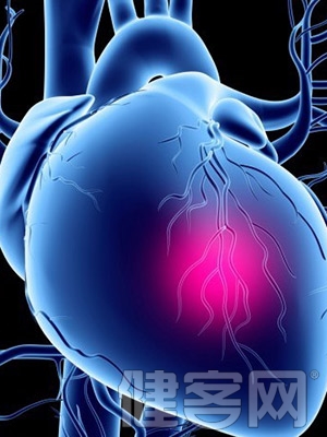 心梗不可怕“防虎”勝於“打虎”