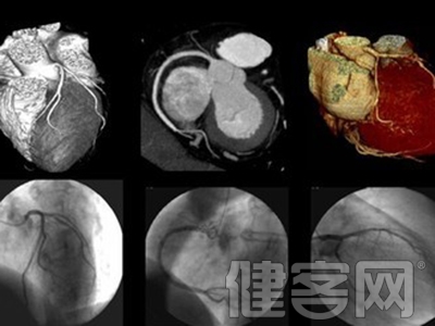 新生兒腦卒中與體重降低密切相關