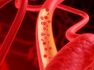 動脈硬化危害全身器官