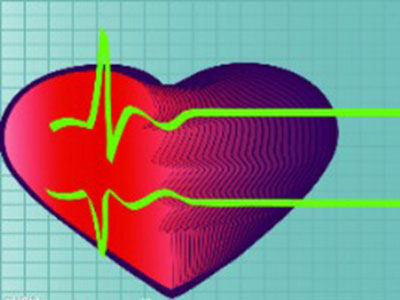 心電圖對冠心病診斷的意義