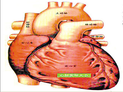 冠心病家族有"4兄弟" 幾款護心藥膳