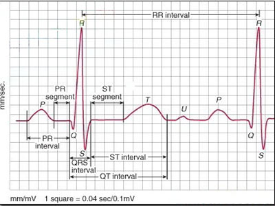 心電圖未必能反應冠心病