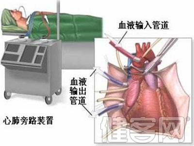 心髒瓣膜病怎樣治？有哪些手術方式？