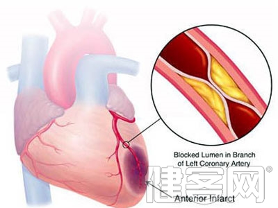 三大冠心病的治療方法