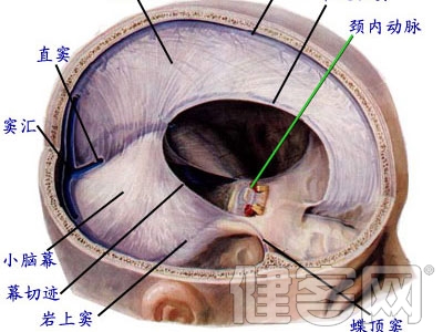 硬腦膜外血腫手術