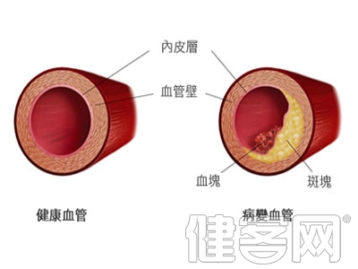 主動脈瓣狹窄的手術特征