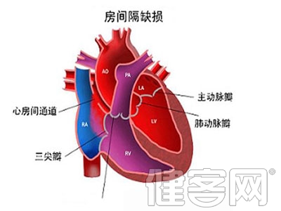 多數先心病手術可治愈