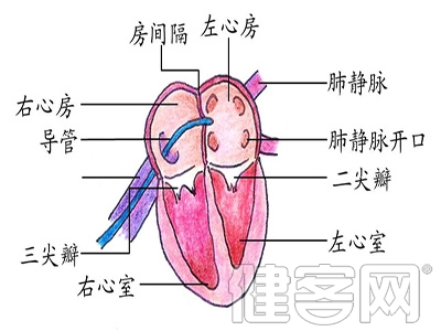 室缺修補術的手術步驟