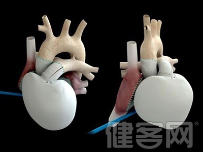 “火箭心”將成心衰患者福音