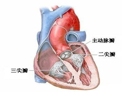 限制型心肌病是什麼症狀？