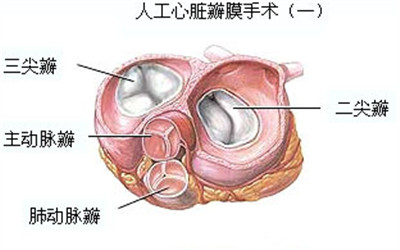 6種心髒瓣膜常見病變