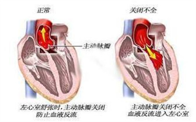 風心病患者的日常：“勞逸結合”