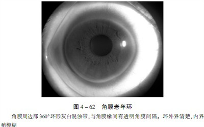 皮膚上種種症狀提示血脂異常