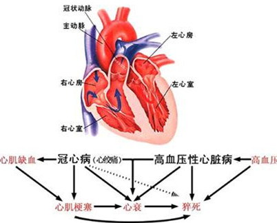 【科普】既有聯系又有區別的3種疾病