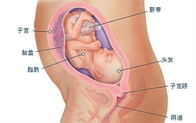 這3大因素易導致新生兒患先心病？准媽媽注意了！