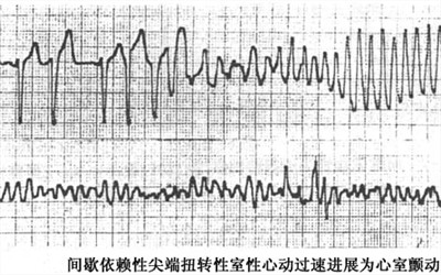 打鼾，你還以為是小事？