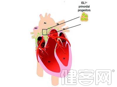 冠心病的早期症狀