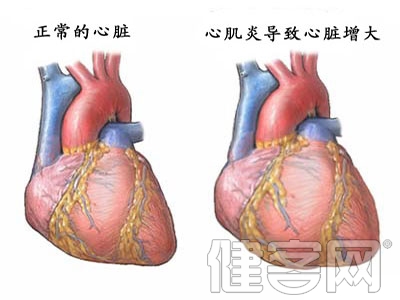 先天性心髒病怎樣分類