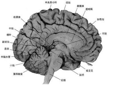 遏制炎症可防腦梗惡化