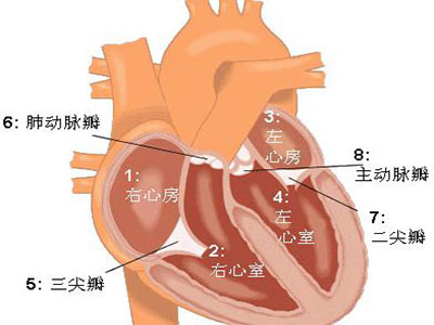 什麼是房間隔缺損？