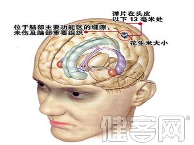 認識心腦血管疾病的危害