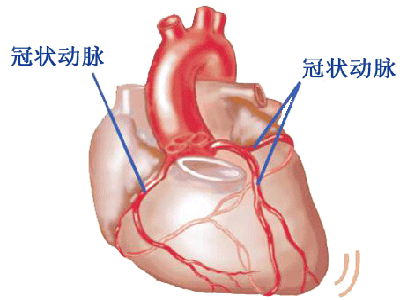 冠心病最愛找機關白領