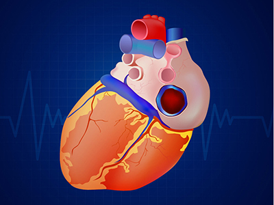 幾個信號預示心髒病變