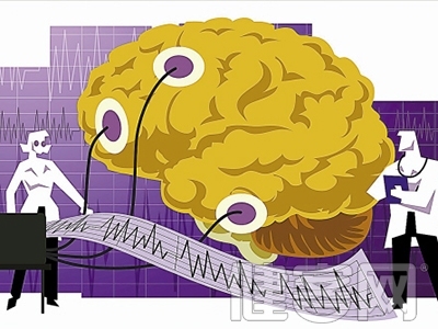 85%的眩暈是腦血管病發病信號