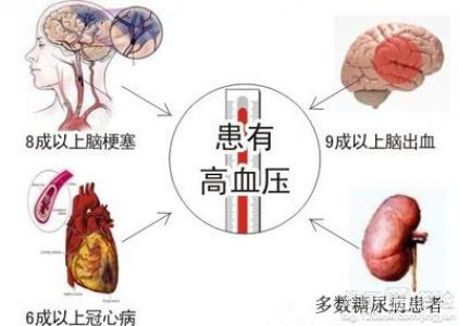 第1步