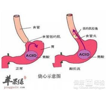 老人高血壓飲食注意