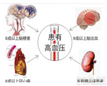 第1步