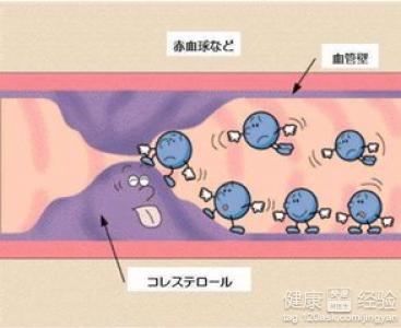 第3步