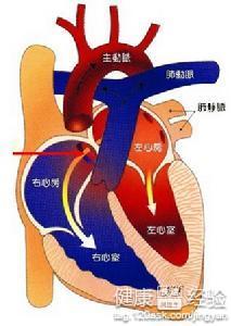 陣發性室性心動