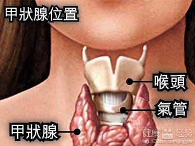 的了甲亢性心髒病的飲食要注意哪些