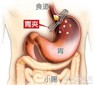 第1步