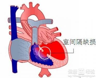 第2步