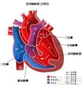 第2步