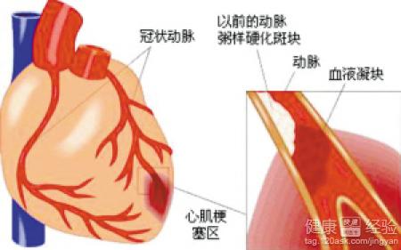 第2步