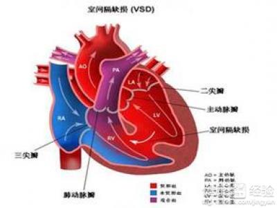 第2步