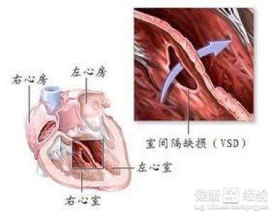 第2步