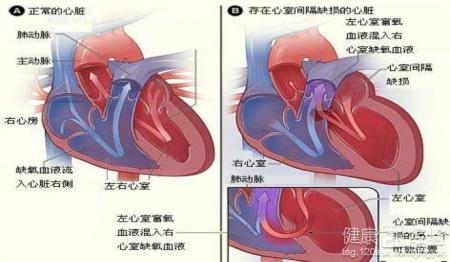 第3步