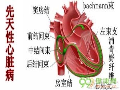 先天性心髒病比較嚴重的有哪些