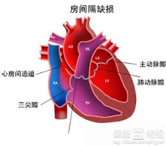 先天性心髒病有幾種