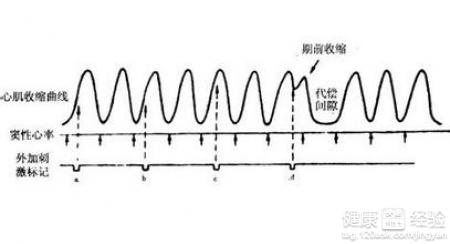 第2步