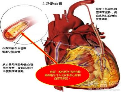 什麼引起高血壓