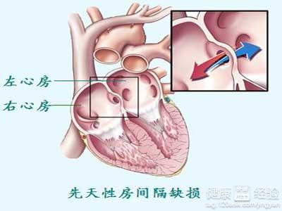 第1步