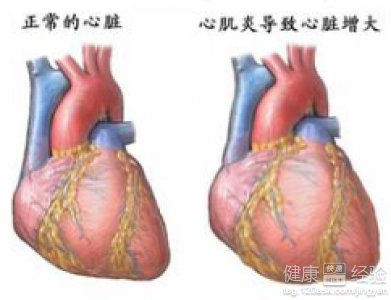 先天性心髒病容易突然發病嗎