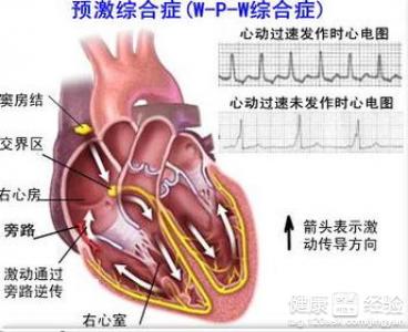 第1步